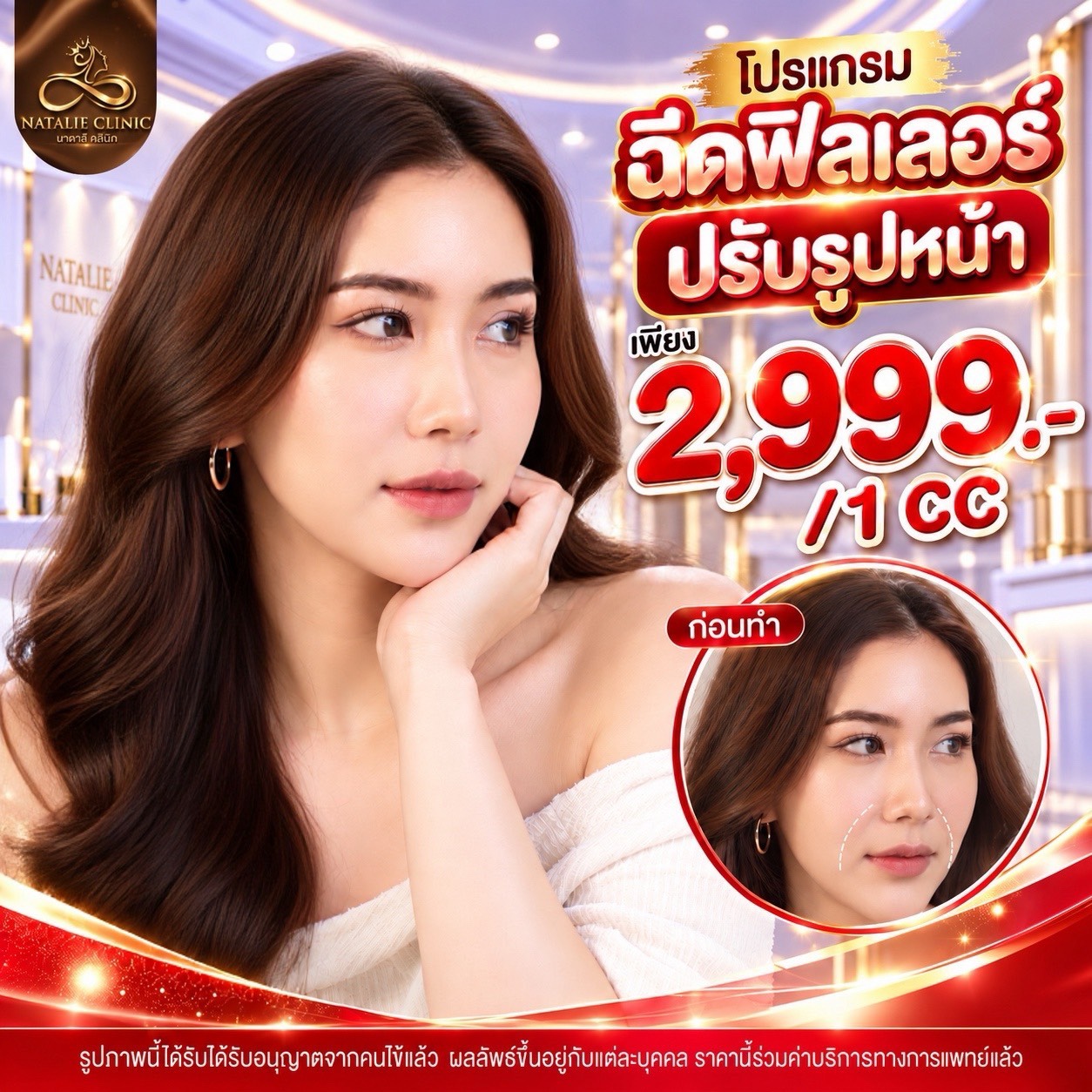 โปรแกรมฉีดฟิลเลอร์ปรับรูปหน้า